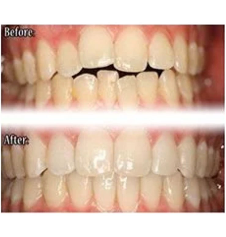 North Bend Dentist Office