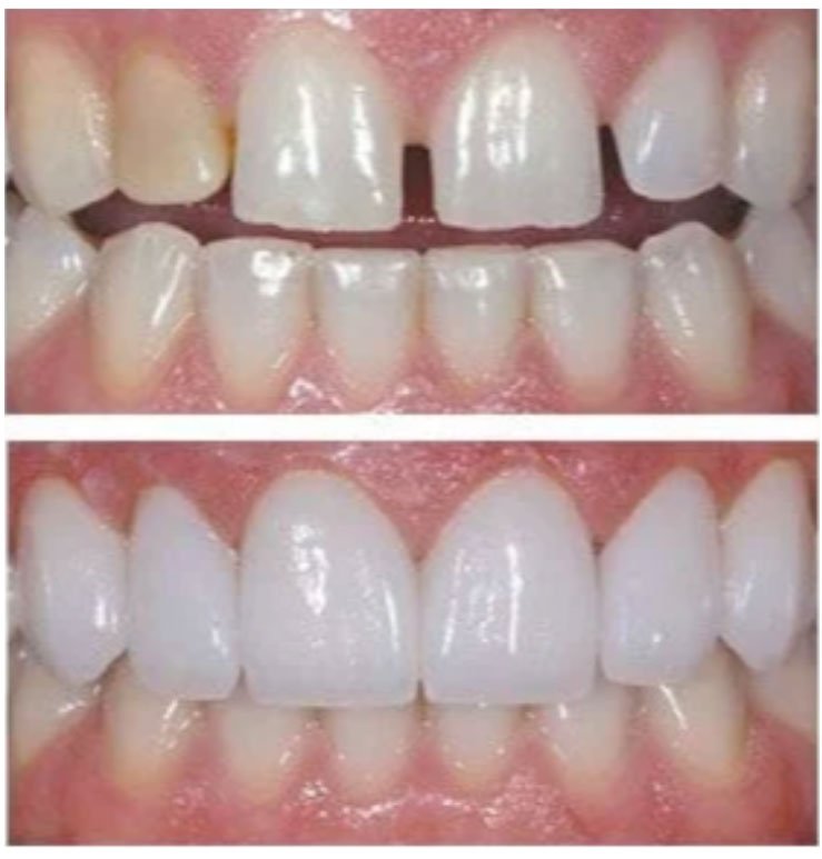 North Bend Dentist Office