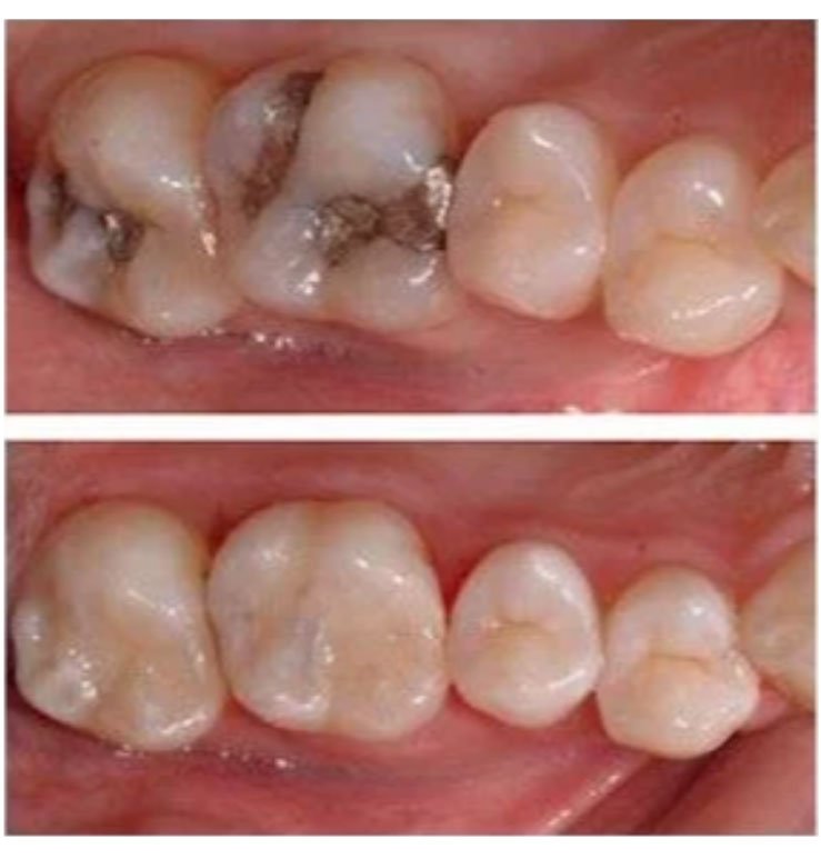 North Bend Dentist Office