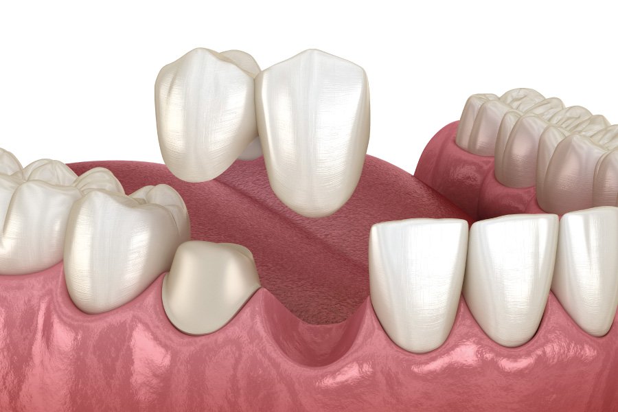 North Bend Cantilever Bridges