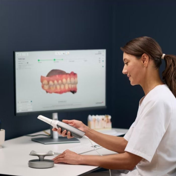 Intraoral Scanner